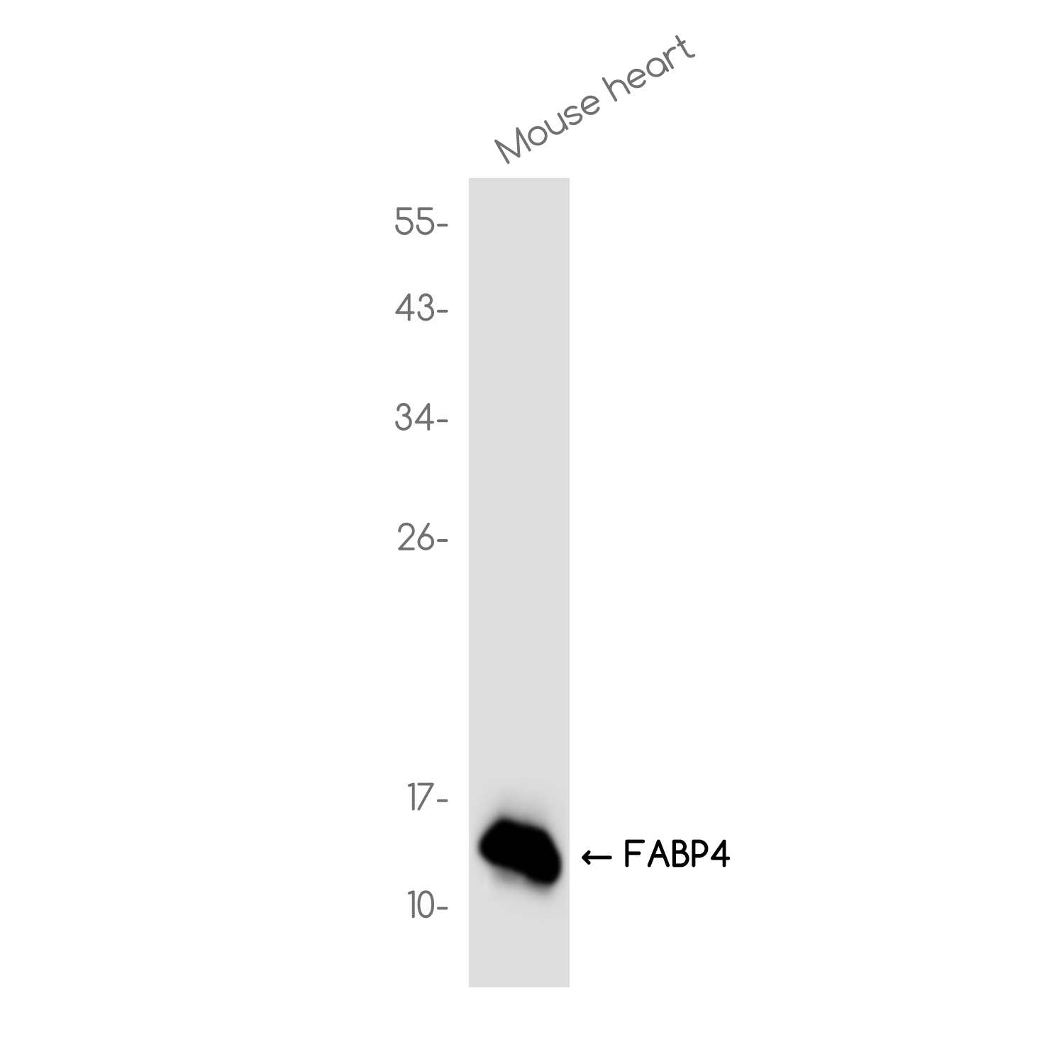 FABP4 Rabbit mAb