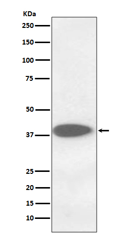 Cathepsin B Rabbit mAb