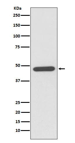 NeuroD1 Rabbit mAb