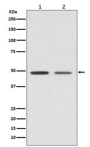 Vitamin D3 Receptor Rabbit mAb