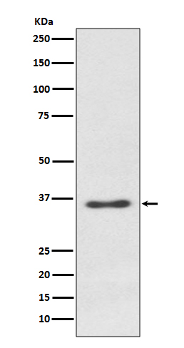 Syndecan 1 Rabbit mAb