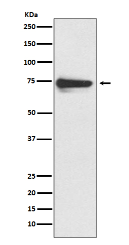 Tyrosinase Rabbit mAb