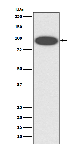 Integrin beta 2 Rabbit mAb