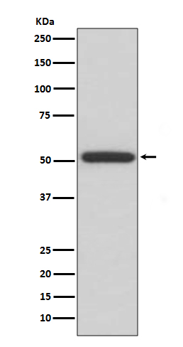 ERp57 Rabbit mAb