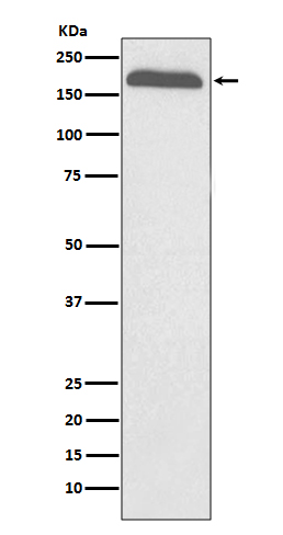 Alpha-2-Macroglobulin Rabbit mAb