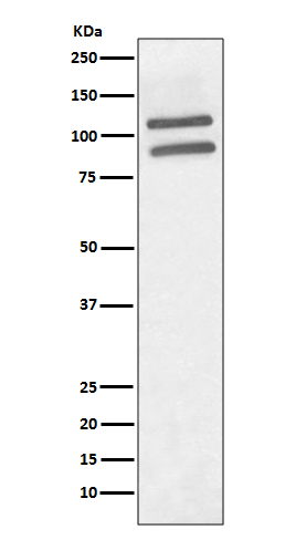 PML Protein Rabbit mAb