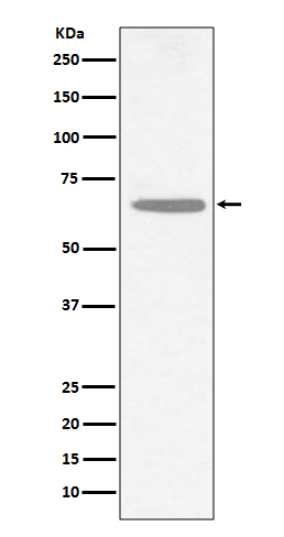 Choline Acetyltransferase Rabbit mAb