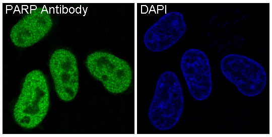 PARP1 Rabbit mAb