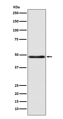 GCET1 Rabbit mAb