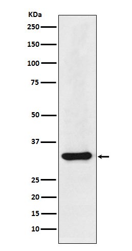 hnRNP A1 Rabbit mAb