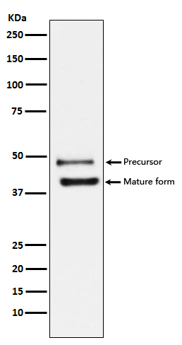 TNFRSF10B Rabbit mAb