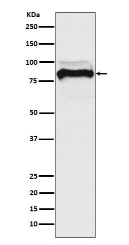 TGF beta Receptor II Rabbit mAb