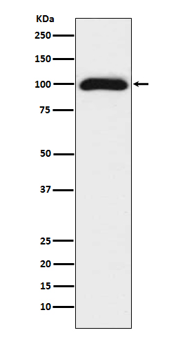 CD276 Rabbit mAb