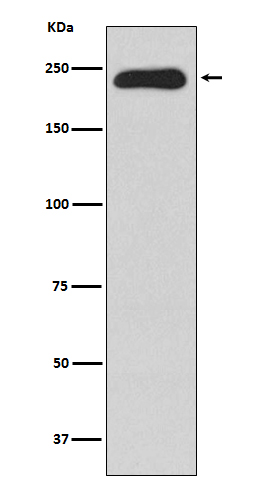 MYH11 Rabbit mAb