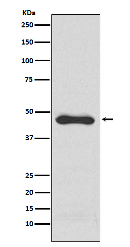 PAI1 Rabbit mAb