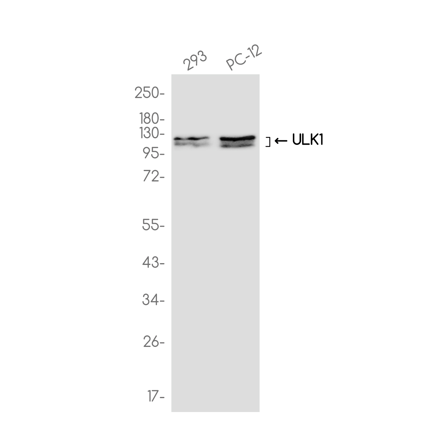 ULK1 Rabbit mAb