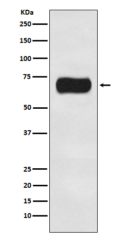 ATG16L1 Rabbit mAb