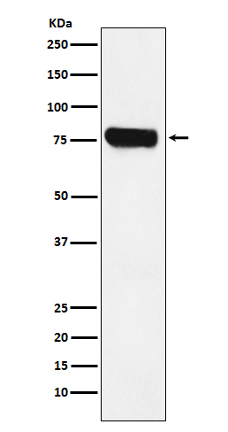 HEC1 Rabbit mAb