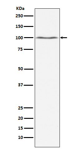 Dynamin 2 Rabbit mAb