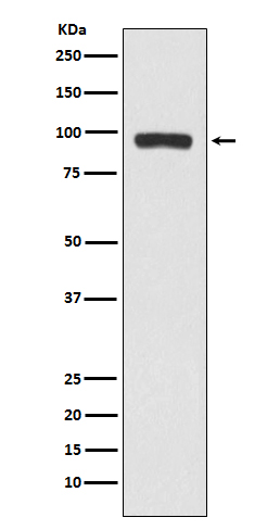 Butyrylcholinesterase Rabbit mAb