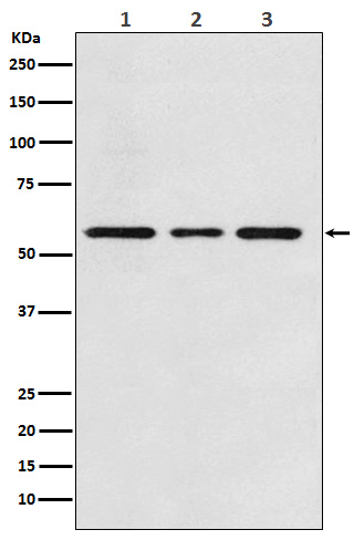 ALK-1 Rabbit mAb