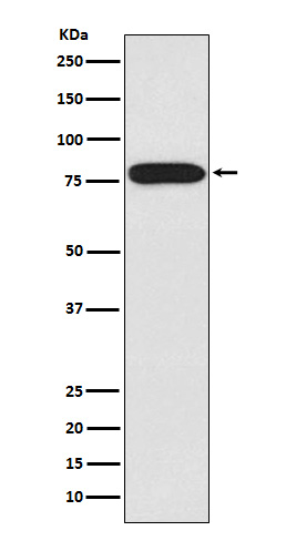 IRAK1 Rabbit mAb