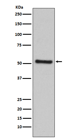 PDCD4 Rabbit mAb