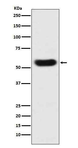 Antithrombin III Rabbit mAb