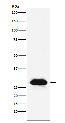 Carbonic Anhydrase 2 Rabbit mAb