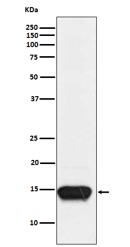 FABP3 Rabbit mAb