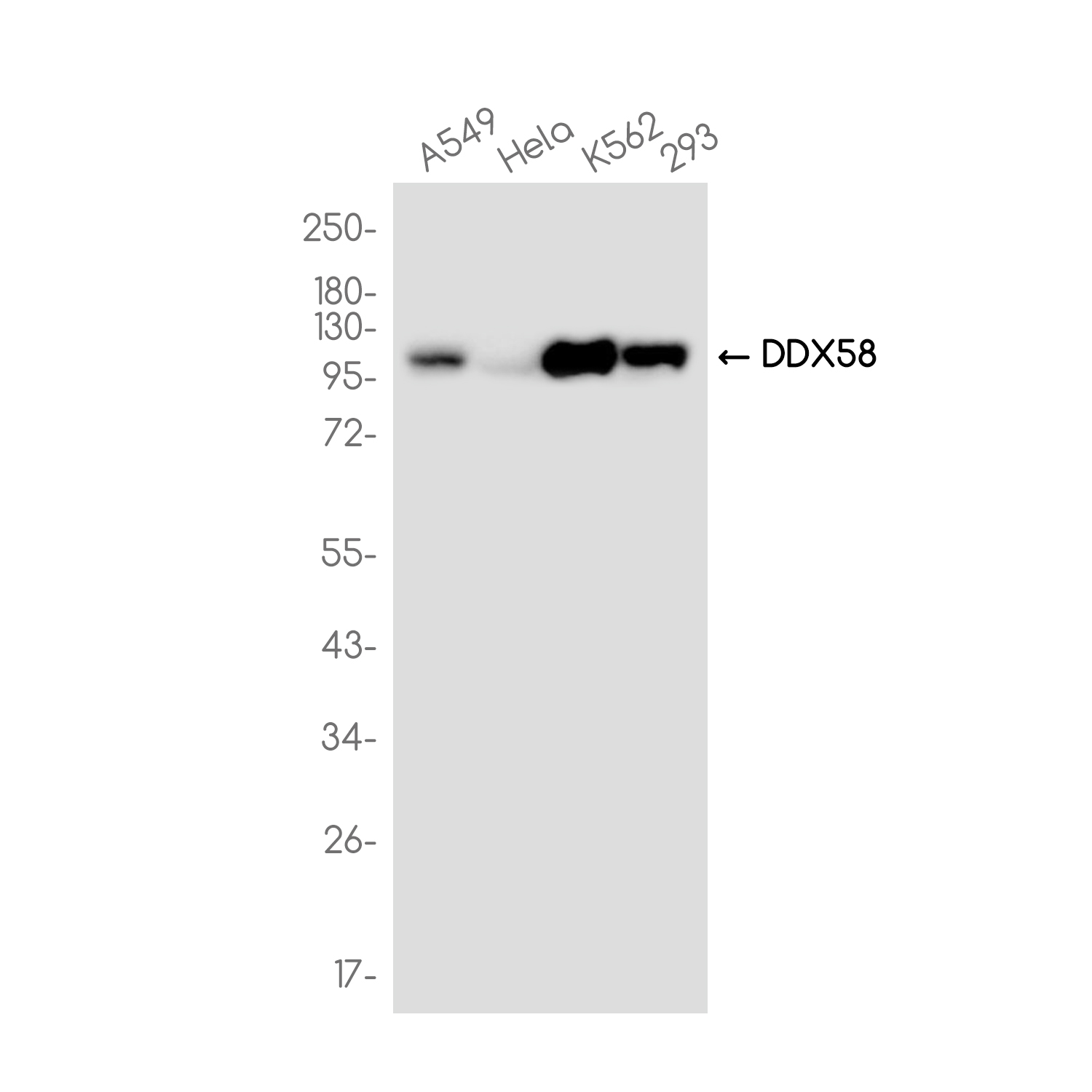 DDX58 Rabbit mAb