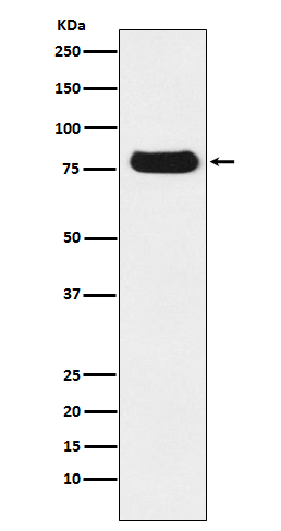 THO Complex Subunit 1 Rabbit mAb