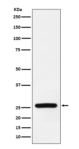 Superoxide Dismutase 3 Rabbit mAb