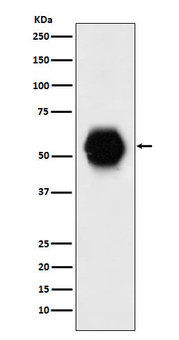 GATA6 Rabbit mAb