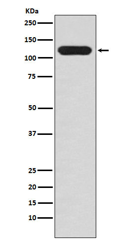 Mucin 4 Rabbit mAb