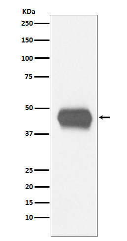 CD1a Rabbit mAb