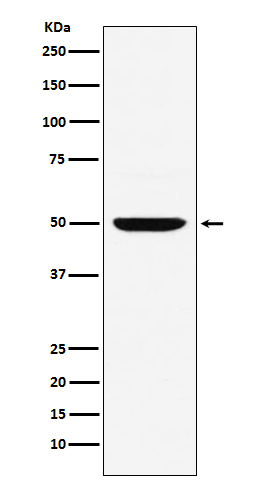 Interferon Regulatory Factor 4 Rabbit mAb