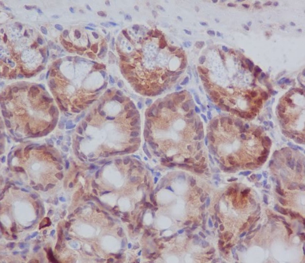 PKC beta 1 Rabbit mAb