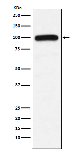 Ubiquitin Protein Ligase E3A Rabbit mAb