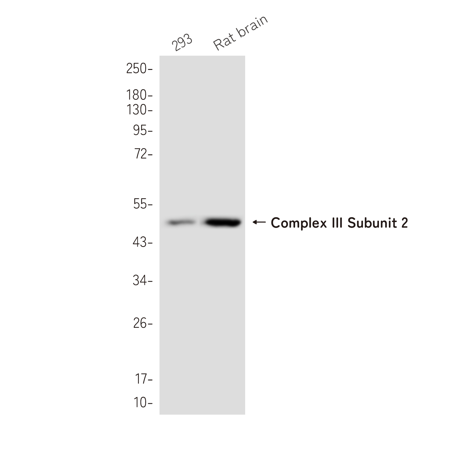 Complex III Subunit 2 Rabbit mAb