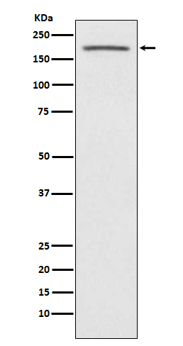 Angiotensin Converting Enzyme 1 Rabbit mAb