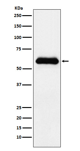 AACT Rabbit mAb