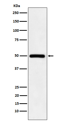 KMT5A Rabbit mAb