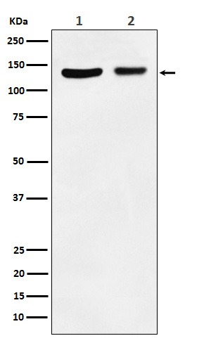 JAK1 Rabbit mAb