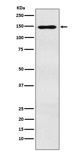 MYBBP1A Rabbit mAb