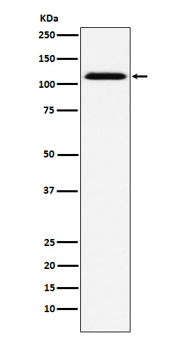 CD30 Rabbit mAb