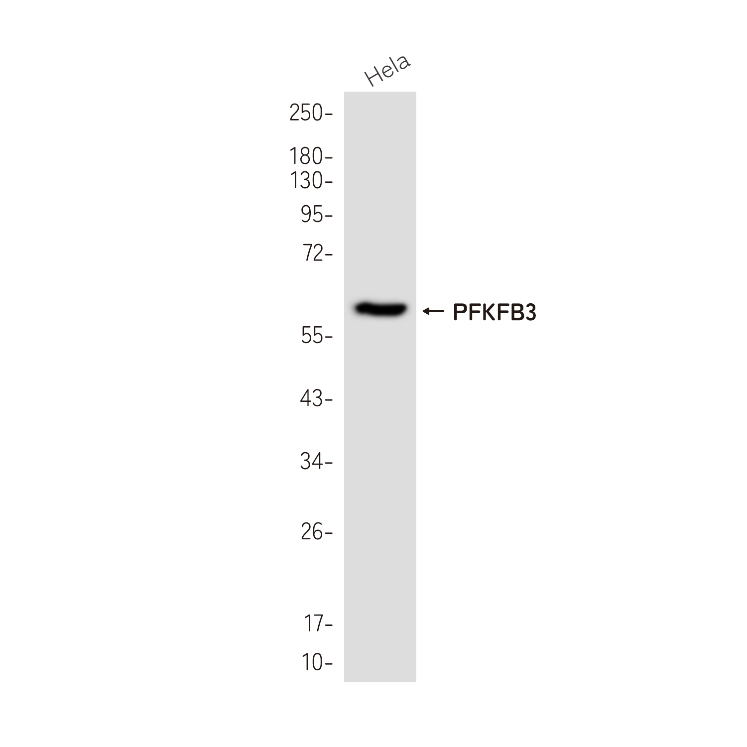 PFKFB3 Rabbit mAb