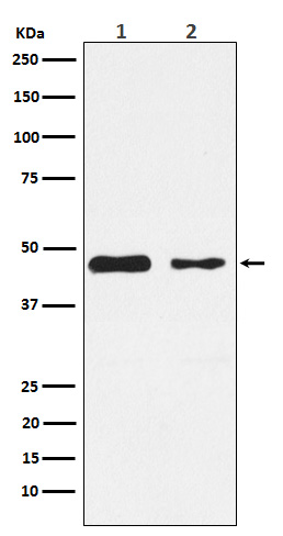 PDK2 Rabbit mAb