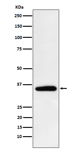 Pyruvate Dehydrogenase E1 beta Rabbit mAb