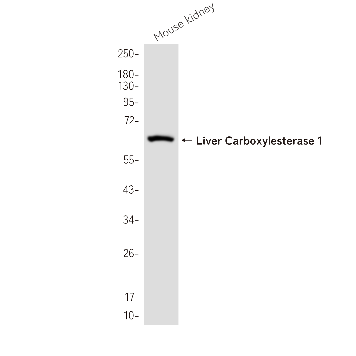 Liver Carboxylesterase 1 Rabbit mAb